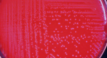 Listeria monocytogenes