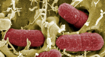 Escherichia coli
